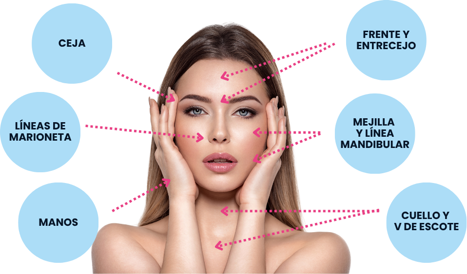 Áreas de aplicación del tratamiento Dermofacial