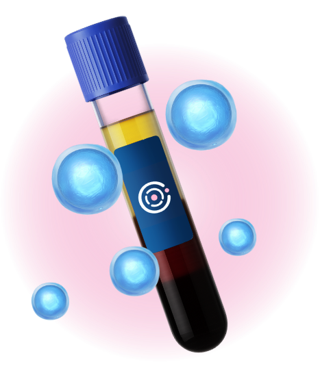 Plasma rico en plaquetas utilizado en el tratamiento Dermofacial